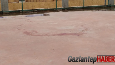 Gaziantep'te pitbull cinsi iki köpek 4 yaşındaki çocuğa saldırdı